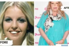 sally thomsett face surgery
