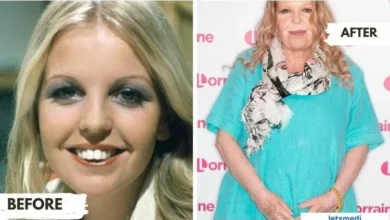 sally thomsett face surgery