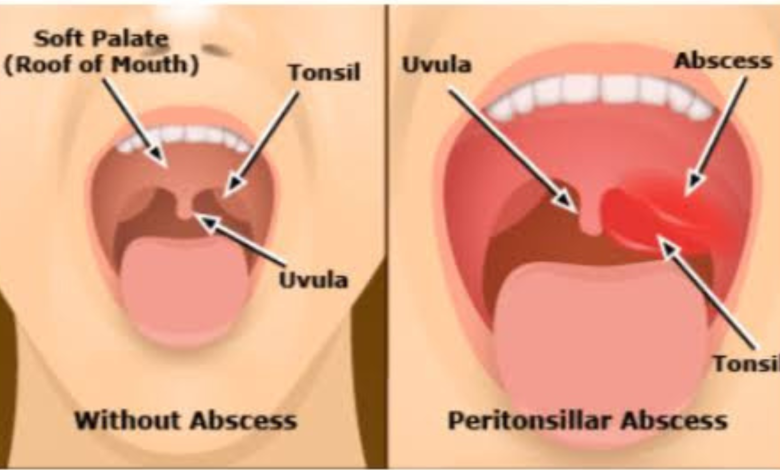 why does one side of my throat hurt when i swallow