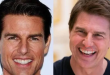 tom cruise middle tooth