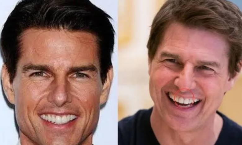 tom cruise middle tooth